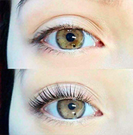 Sammenligning av to øyne, det nederste har løftede vipper